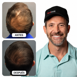 Redroott · Gorra de Terapia de Luz Roja para Crecimiento Capilar 6