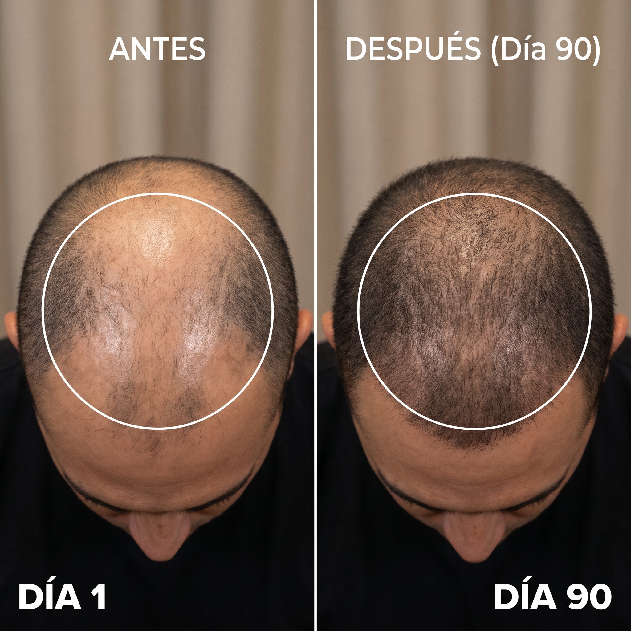Resultado 1