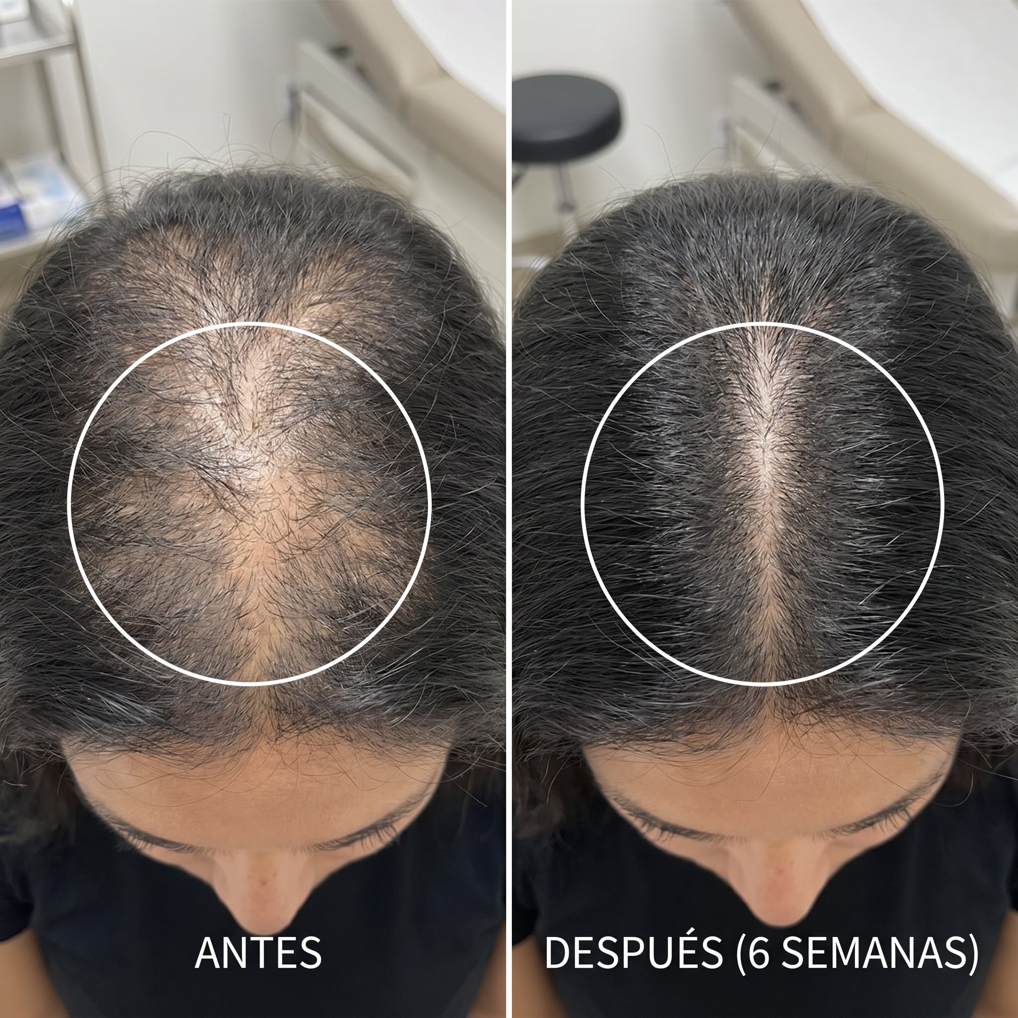 Resultado 3